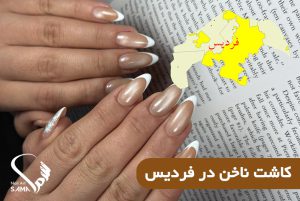 کاشت ناخن در فردیس