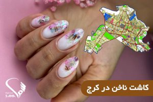 کاشت ناخن در کرج